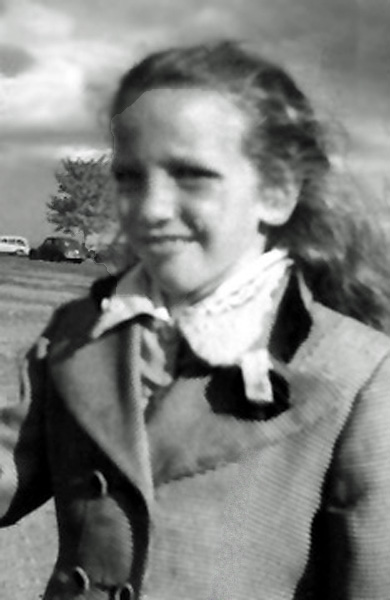 Karen and her black eye